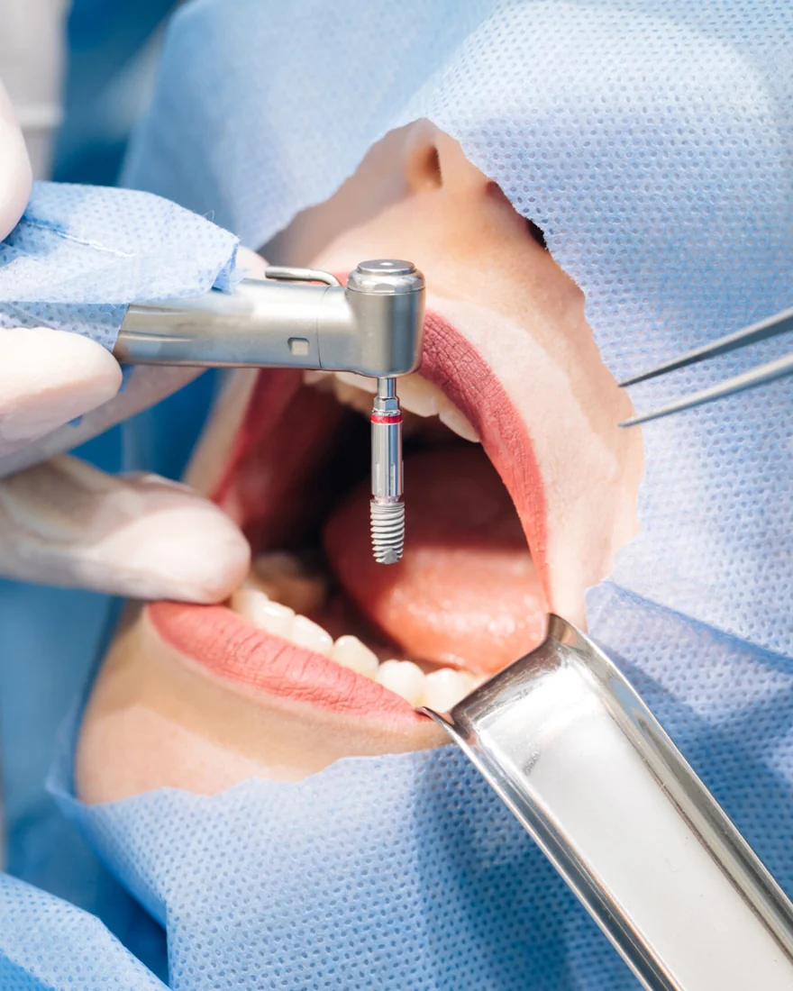 Cirugía dental en quirófano