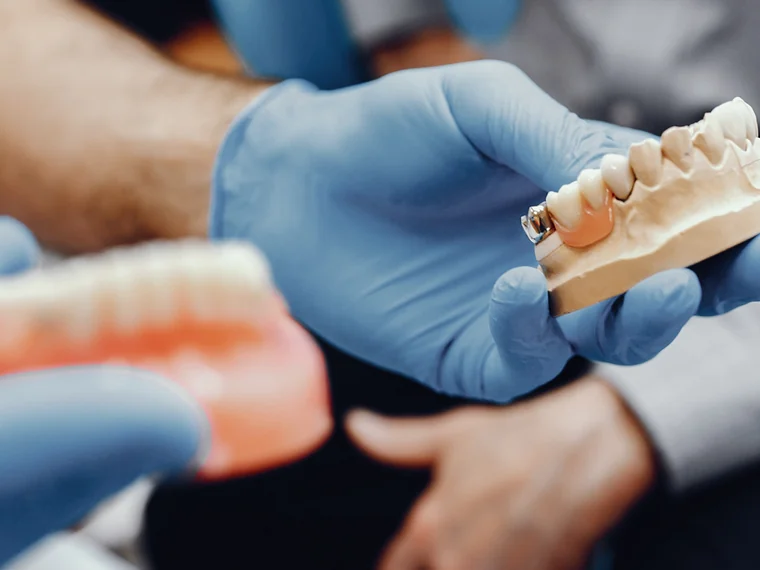 Prótesis dentales removibles