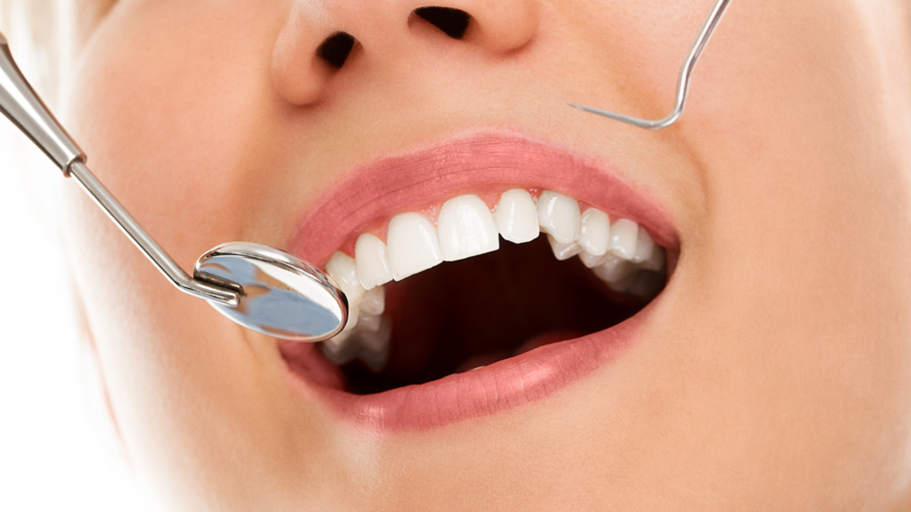 Paciente recibiendo una limpieza dental profesional en DentPrax